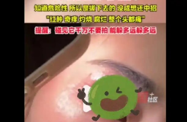 被称为“会飞的硫酸”，6-9月进入隐翅虫活跃期