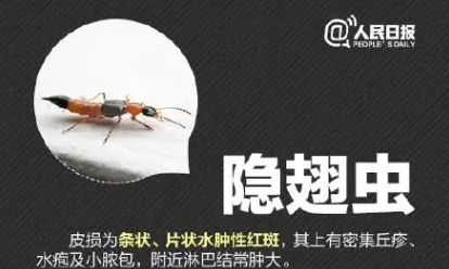 一条虫子竟然上了热搜！遇到隐翅虫该怎么办？